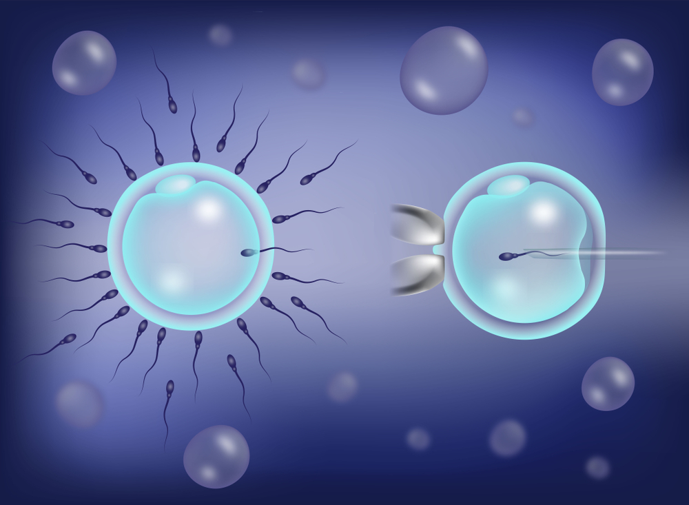 The Best IVF Centre in Gujarat: How to Choose the Right One for You