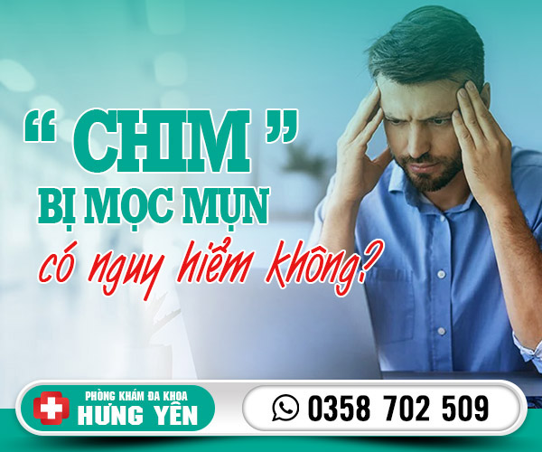 Chim bị mọc mụn có nguy hiểm không?