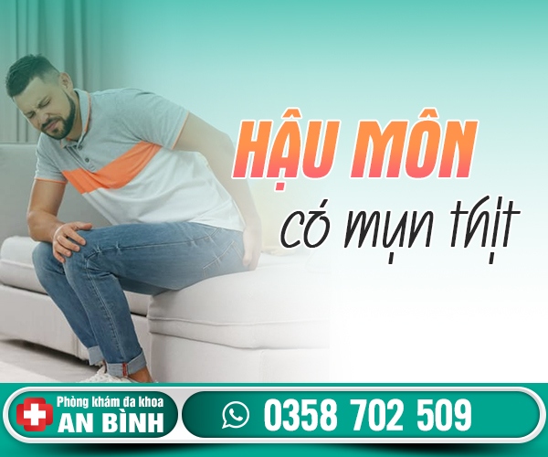 Hậu môn có mụn thịt bị làm sao? Nguy hiểm không?