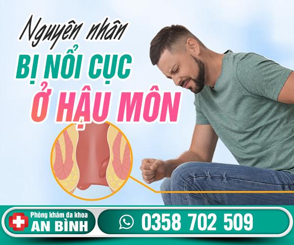 Bị nổi cục ở hậu môn: Nguyên nhân, dấu hiệu và cách điều trị