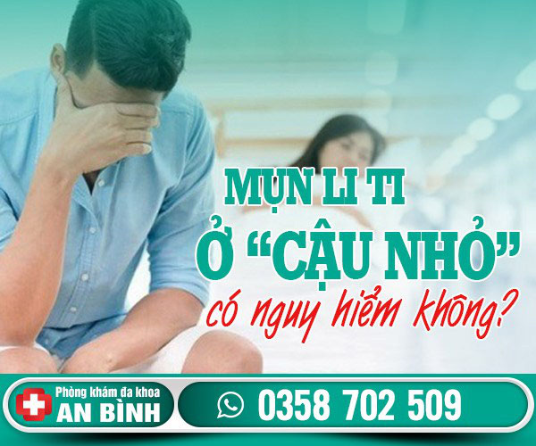 Mụn li ti ở cậu nhỏ: Nguyên nhân và cách chữa - Khám phụ khoa Hưng Yên