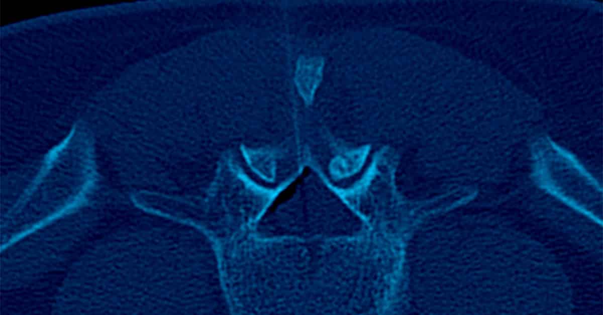 Interventional Radiology Procedures in Melbourne: Book Now