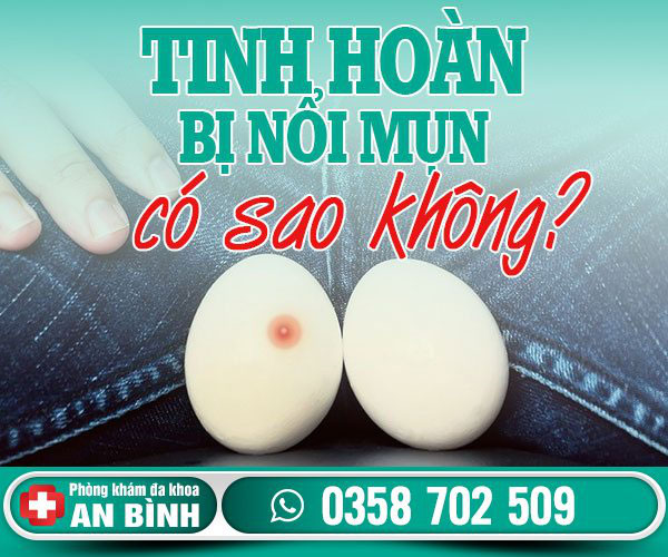 Tinh hoàn bị nổi mụn: Nguyên nhân, dấu hiệu và cách chữa - Khám phụ khoa Hưng Yên