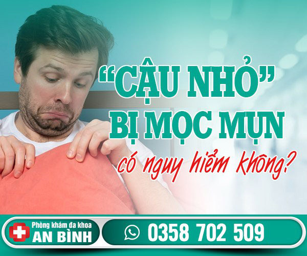 Cậu nhỏ bị mọc mụn: Nguyên nhân và cách điều trị triệt để - Khám phụ khoa Hưng Yên